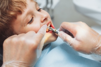 Councils warn of a dramatic fall in teeth extractions due to pandemic image